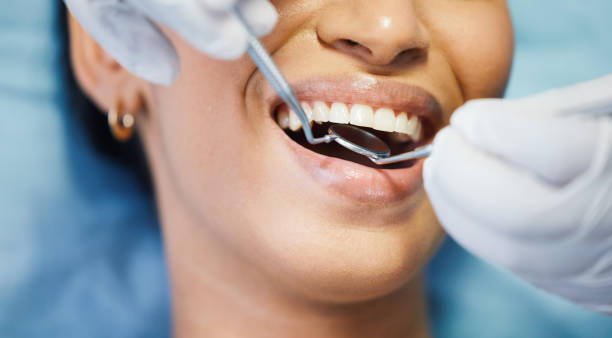 Best Dentist for Tooth Abscess  in Hoxie, KS