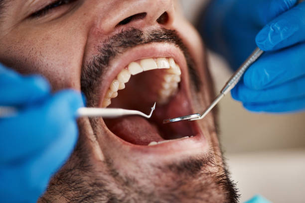 Best Broken Tooth Emergency  in Hoxie, KS
